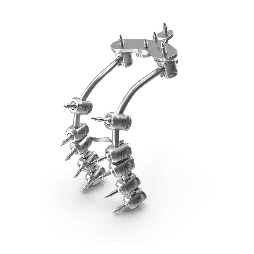 Implant metalic - Clinica Medicala Grama
